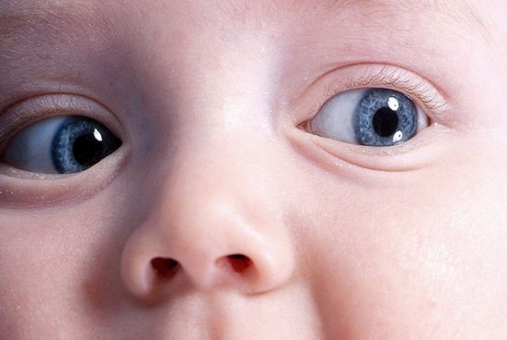 Як змінюється колір очей у новонароджених