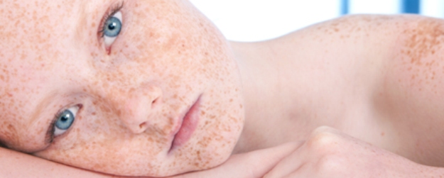 Як зменшити прояви пігментації шкіри