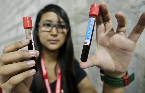 Канадские учёные нашли способ превращать разные группы крови в «универсальную» – первую