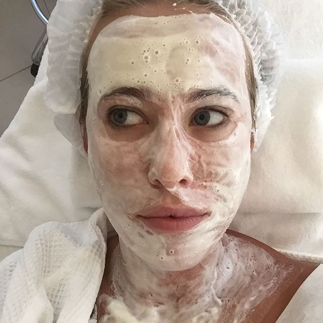 Ксения Собчак перепугала лицом в косметической маске