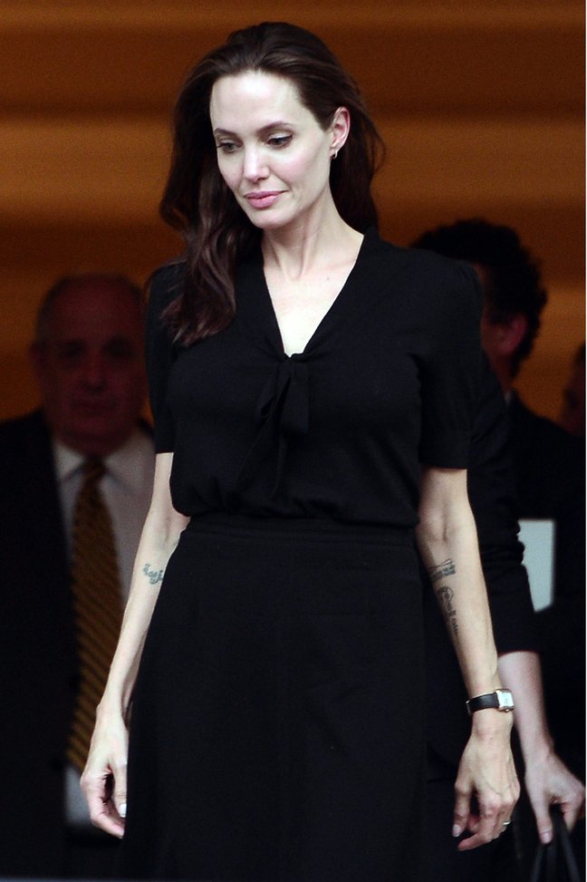 Врачи рассказали о страшном состоянии Анджелины Джоли