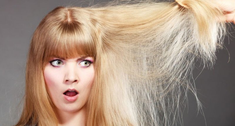 Выпадение волос: как бороться с этой проблемой