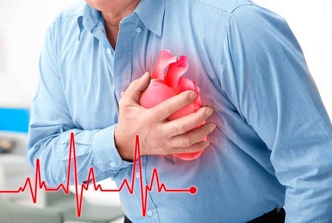 П'ять причин серцевого нападу, на які часто не звертають уваги